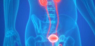 Bladder Cancer Treatment - Dr. Manoj Dongare