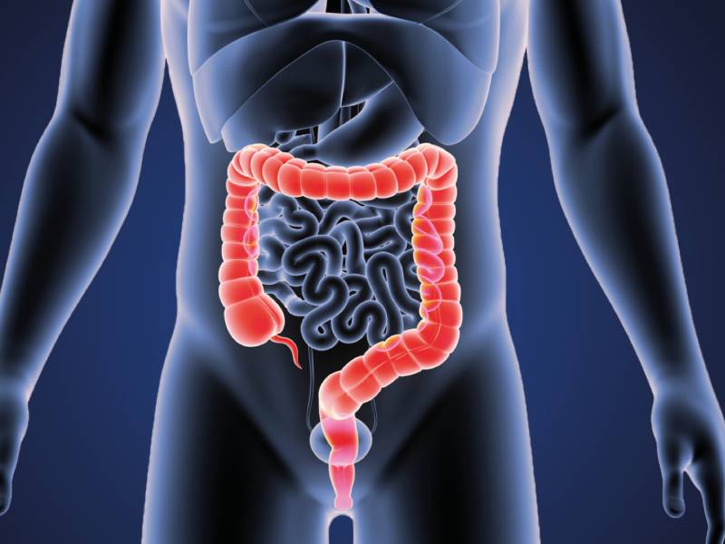Colorectal cancer specialist in Pune