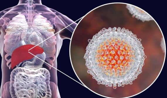 Hepatitis C Treatment in Pune | HCV Treatment