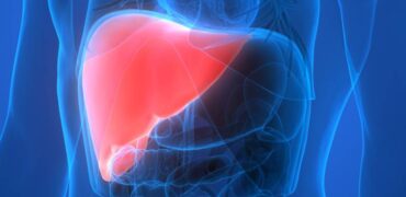 Nonalcoholic Steatohepatitis (NASH) Treatment in Pune