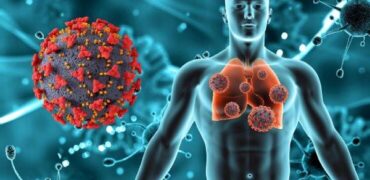 Lung Cancer Lung Cancer Treatment in Pune - Dr. Manoj Dongare