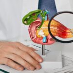 Pancreas model showing inflammation examined by doctor – Dr. Manoj Dongare, HPB Surgeon in Pune