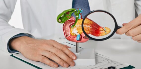 Pancreas model showing inflammation examined by doctor – Dr. Manoj Dongare, HPB Surgeon in Pune