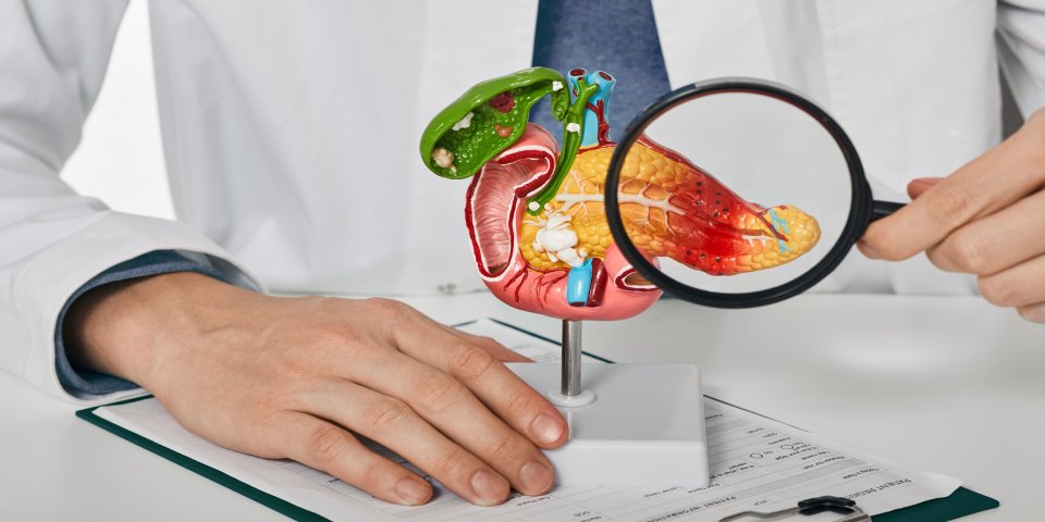 Pancreas model showing inflammation examined by doctor – Dr. Manoj Dongare, HPB Surgeon in Pune