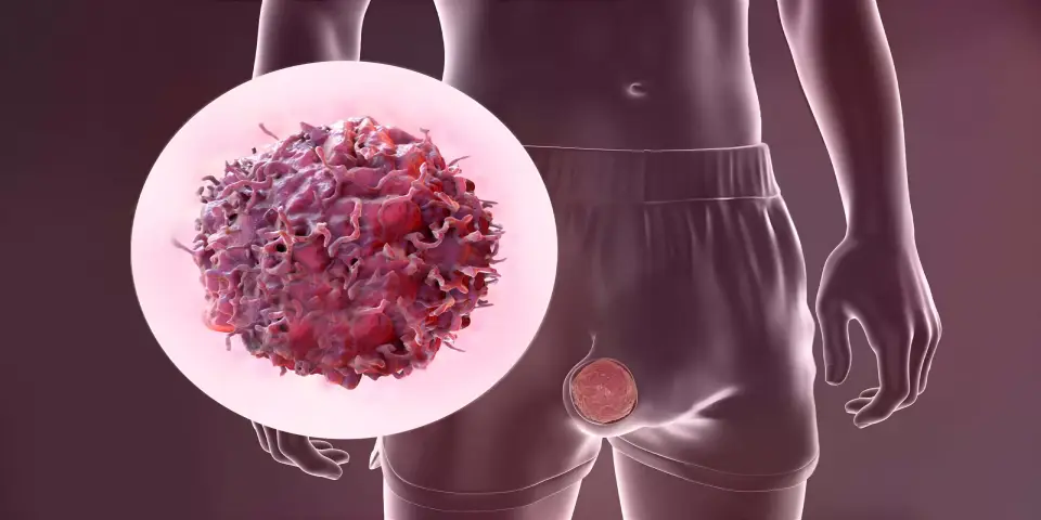 3D illustration showing a testicular cancer cell and male reproductive anatomy highlighting risk factors for testicular cancer.