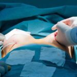 Surgical team performing reconstructive breast surgery after mastectomy in an operating room.