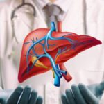 Doctor explaining Liver Transplant for Liver Cancer with anatomical liver illustration