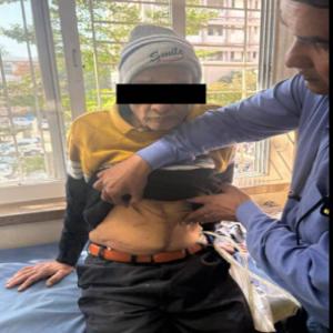 Complex Liver Cancer Surgery in a 75-Year-Old Patient 2